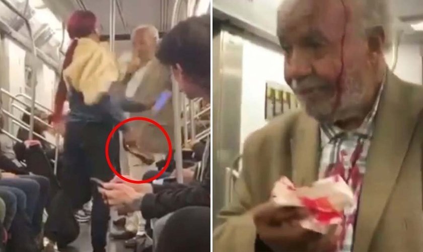 Agressora [à esquerda] e idoso ensanguentado após ser agredido [à direita]. (Foto: Reprodução/CBS)