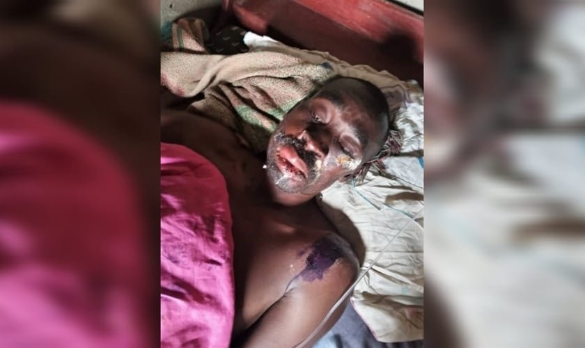 Frank Mutabaazi sofreu uma emboscada de um extremista, que fingiu ser membro de uma igreja. Ele está com dificuldade de falar e se alimentar devido às queimaduras na boca.