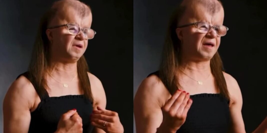 Kenzie sorri, olhando para a câmera, com a Síndrome Progeroide de Fontaine.