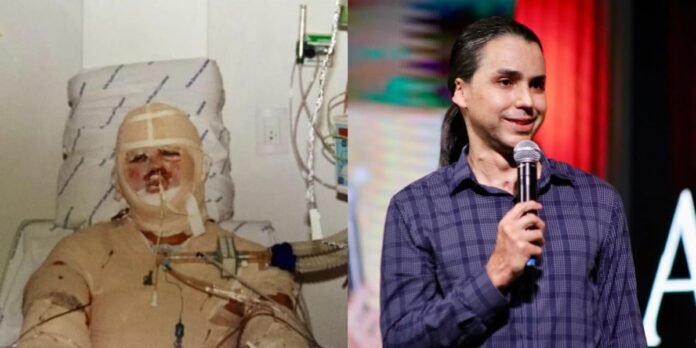Sobrevivente de grave acidente com queimaduras celebra milagre de vida Pastor David Augusto com cicatrizes de queimaduras, expressando gratidão e fé