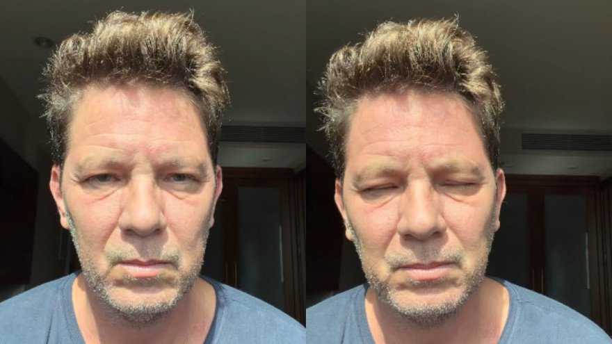 Deputado Mario Frias em quarto de hospital após procedimento médico