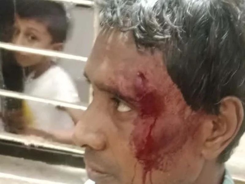 Homem ferido em oficina de bicicletas em Bangladesh após agressão por sua fé